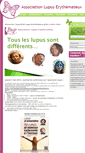 Mobile Screenshot of lupus-belgium.all2all.org